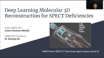 DL Molecular 3D Reconstruction to Combat SPECT Deficiencies | SJSU CMPE 294 Research