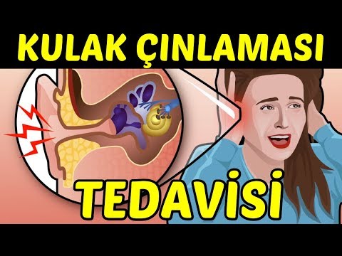 Video: Fil Kulak Ampul Çeşitleri - Farklı Fil Kulak Bitkileri Nelerdir?