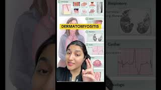 Dermatomyositis is confused for dry skin which delays diagnosis