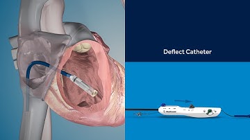 Micra TPS Implant Procedure Animation