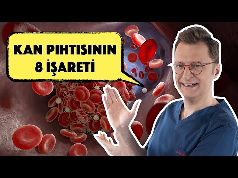 Video: Kan Pıhtıları Nasıl Önlenir (Resimlerle)