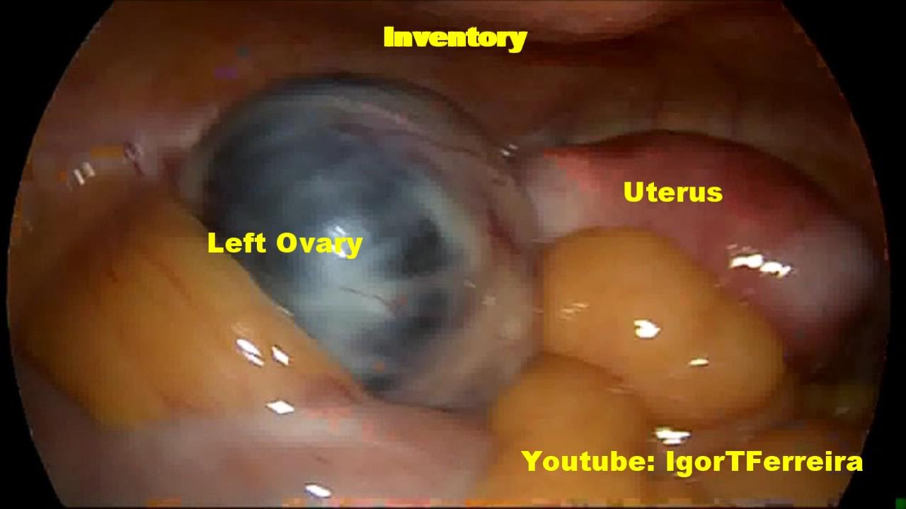 how big is an ovary