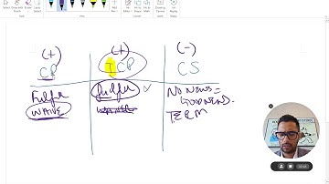 🎯 Condition Precedent vs True Condition Precedent vs Condition Subsequent
