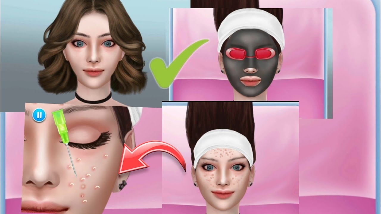 ASMR Acne Removal skin care animation and games Acne Extract pimples popping!! Creation for