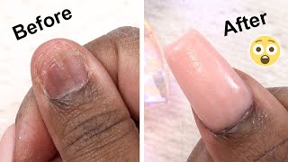 MY Real Nail Came OFF!  Here's How I Fixed It!
