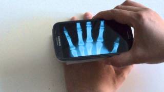 Xray Scan Android Review screenshot 4