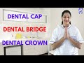 Dental Cap/Crown & Bridge Treatment, Front & Back Teeth, after RCT, Types|| दाँत की टोपी in Hindi