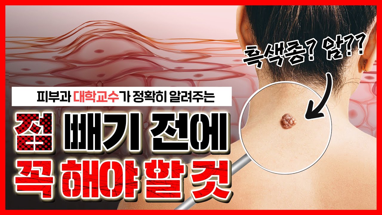 피부 조직 검사를 하면 오히려 개이득이라고?!🤷‍♀️ ( ※ 검사 이름만 무서움 ※ ) - [언니네피부과]