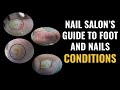 Nail salons guide to foot and nail conditions