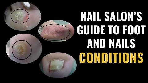 Nail Salon's Guide To Foot and Nail Conditions