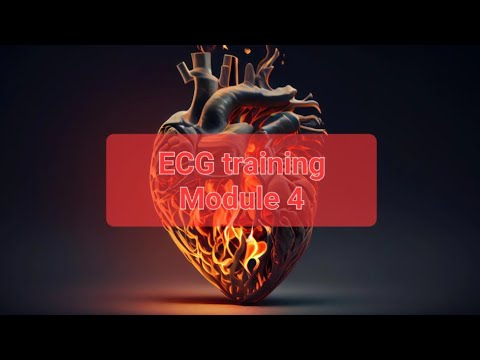 Mindware Training Module Ecg ECG training Module 4 ppt - YouTube