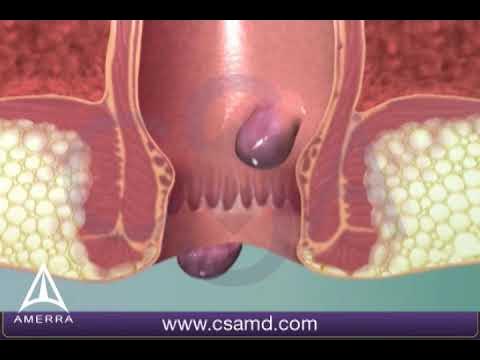 Harakat bilan jinsiy aloqa