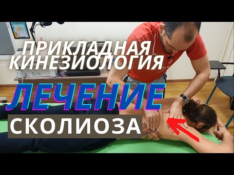 Сколиоз. Быстрая коррекция и лечение боли. Остеопатия и кинезиология