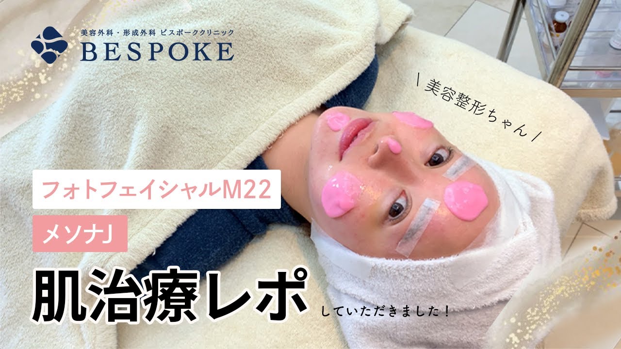 美容整形ちゃんが肌治療体験！気になる赤ら顔や肌への効果、ダウンタイムは？【フォトフェイシャル・M22】【エレクトロポレーション・メソナJ】