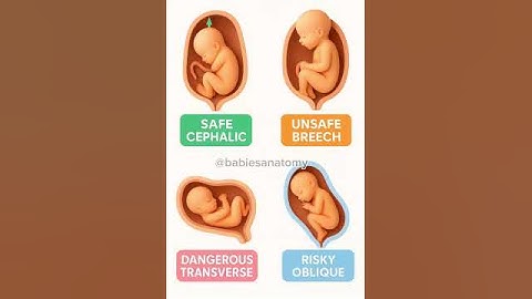 Fetal Positions Explained Safe vs Risky Pregnancy Positions #fetaldevelopment #fetalposition #short