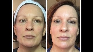 RESULTS ARE IN 12 Day Home Use Microcurrent Challenge