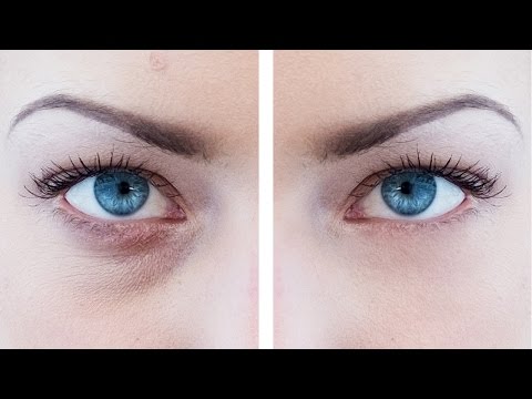 Learn how to naturally remove eye bags in photoshop cc 2017. retouching dark circles around the eyes can be divided into two parts: removing wrinkles and...