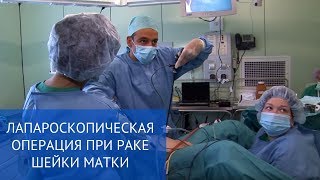 Лапароскопическая операция при раке шейки матки