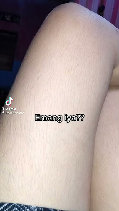 Inikah yang kalian cari wanita dengan bulu tangan dan kaki