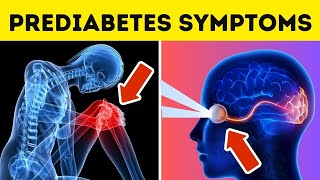 Top 12 PREDIABETES Symptoms and Treatment You Should't IGNORE