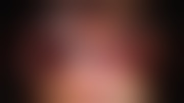 Robotic ureteric re implant