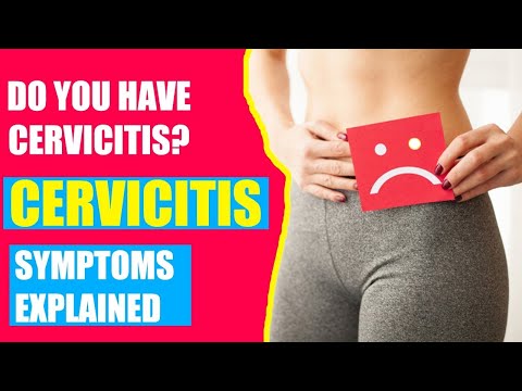 Video: Ką reiškia endocervicitas?