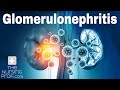 Renal Emergencies: Glomerulonephritis