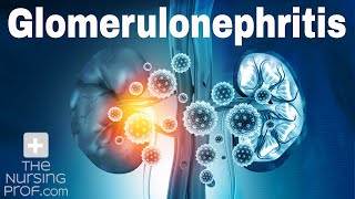 Renal Emergencies: Glomerulonephritis
