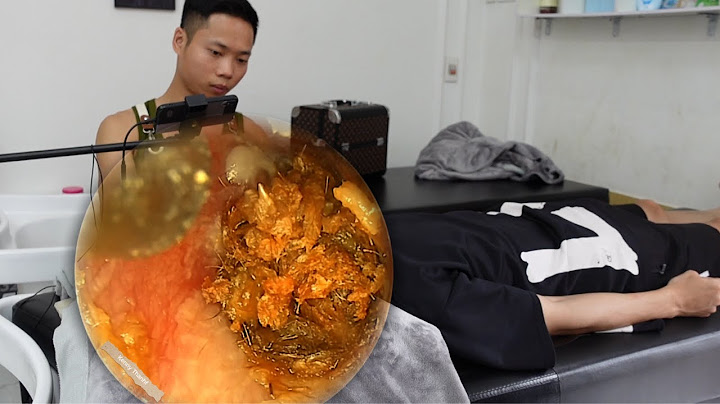 Giant Earwax For Sleep | ASMR Earwax Removal | Giant Earwax KennyThanhf14
