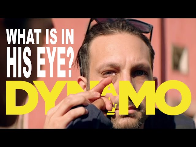 A woman pushes a mint out of Dynamo's eye
