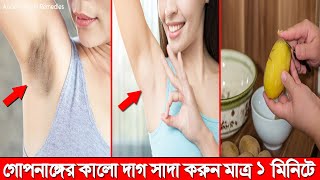 মাত্র ১ মিনিটে আপনার গোপন অঙ্গের কালো দাগ দুর হবে গ্যারান্টি || Just 1 minute whiteing Dark Underarm