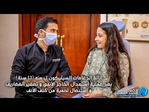 فيديو: دعامات الرافعة: فوهة مطاطية لمقبس الزجاجة ، محمل مشقوق ودفع. كيفية اختيار؟