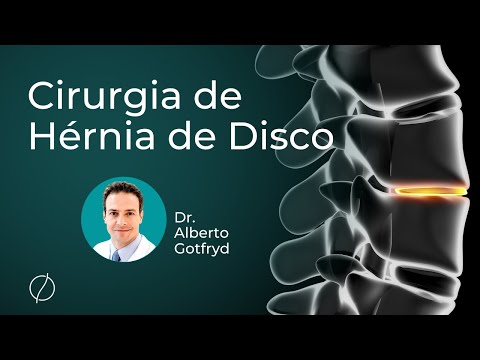 Vídeo: Você precisa de cirurgia para uma hérnia de disco?