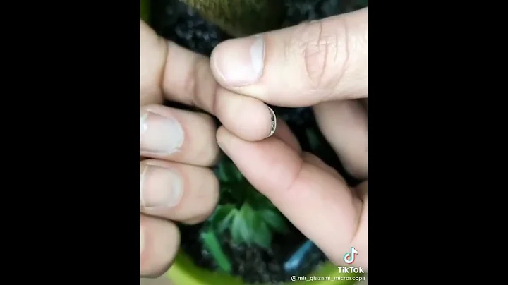 Microbes in the nails: microorganisms effects 2021 - 天天要聞