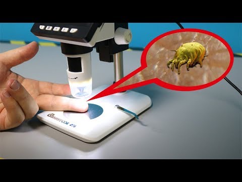 Video: Ein Roboter Auf Saugnäpfen Untersucht Die Haut Unter Einem Mikroskop