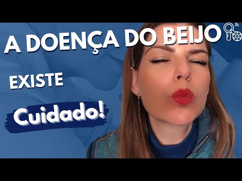 Mononucleose infecciosa = A DOENÇA DO BEIJO - como se pega, como se trata e quais sinais e sintomas