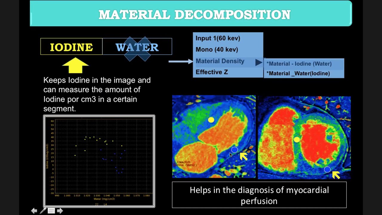 Role of Spectral CT in Cardiovascular Imaging