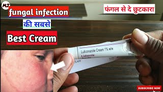 LidazoleCream1%फंगल को करें जड़ से खत्म| Cream For skin allergy,Fungal Infection|MedicalJanakari