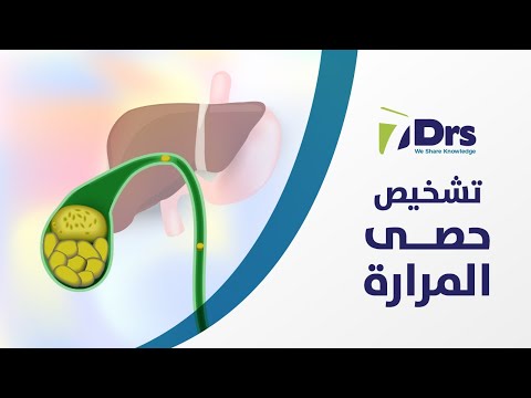 فيديو: كيفية تشخيص حصوات المرارة (بالصور)