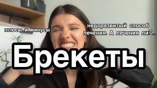 Брекеты: мой опыт || почему я сняла ритейнеры | удаление восьмерок