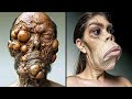 15 real people with extremely weird diseases