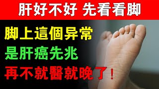 肝好不好，先看看腳！腳上若出現3個「求救信號」，是肝硬化、肝癌的警報！再不就醫就晚了！#健康知識 #老年健康 #健康養生 #老年養生