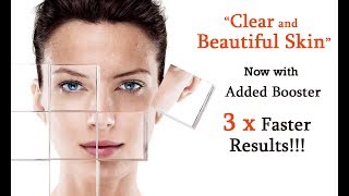 Clear and Beautiful Skin with Added Booster by Simply Hypnotic | Perfect Skin Binaural Recording