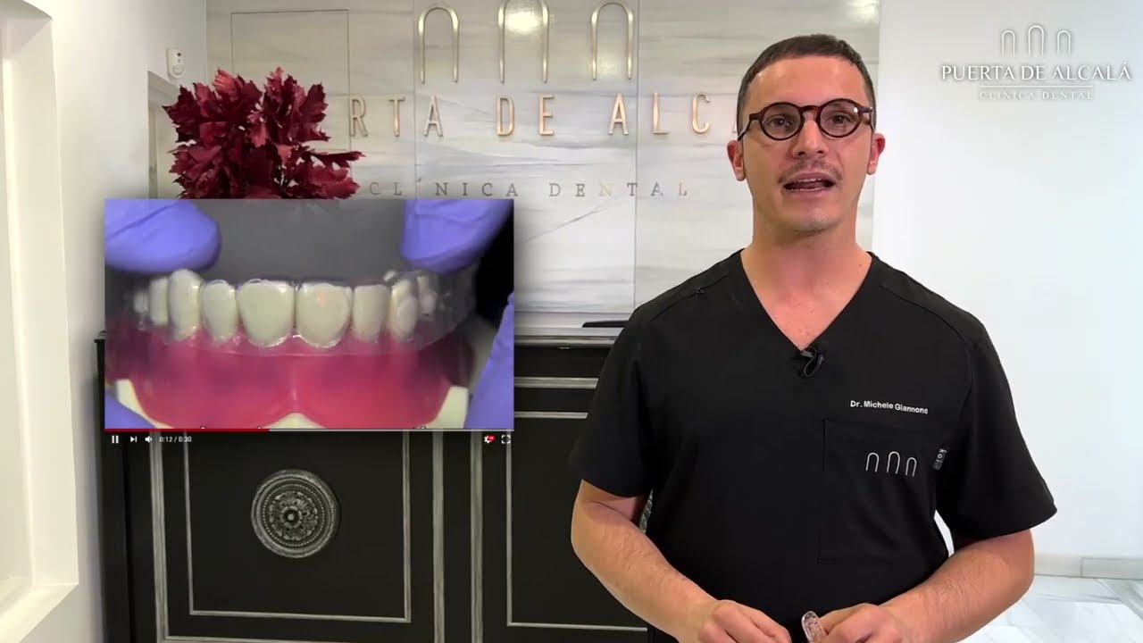 Férula de descarga para tratar bruxismo y TMD: todo lo que necesita saber -  Clínica Dental Rocamora