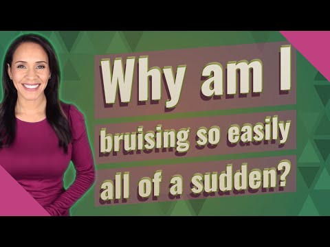 Why am I bruising so easily all of a sudden?