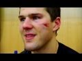 Ben lovejoy takes a puck to face pittsburgh penguins
