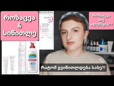 როზაცეა და სიწითლე სახეზე / Nina Todria