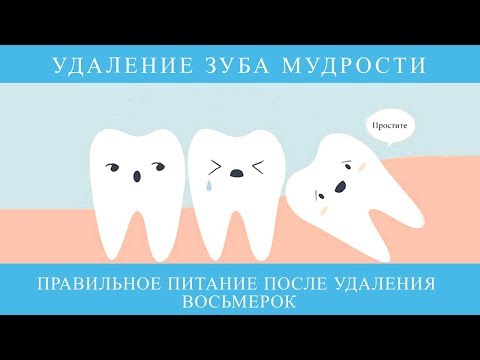 Видео: Что есть после удаления зубов мудрости: есть и избегать