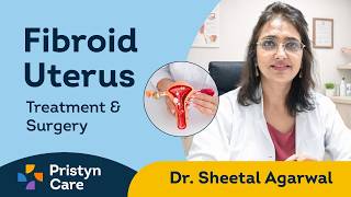 Fibroid Uterus Treatment & Surgery | Dr. Sheetal Agarwal, Senior Gynecologist