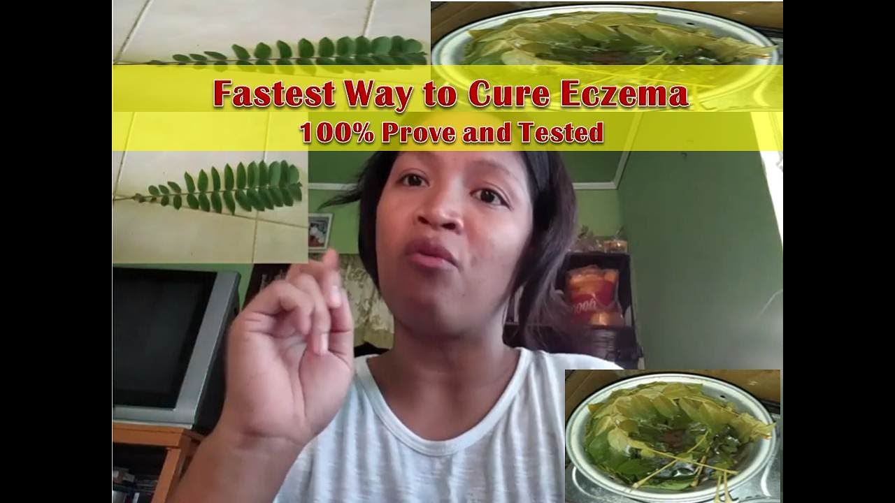 How to cure ECZEMA Cheapest and Easy Way? 